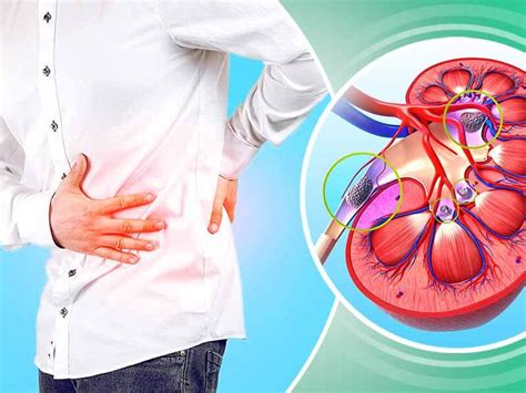 Kidney stones may form when there's a change in the normal balance of the water, salts, and minerals found in urine. How to get immediate relief from kidney stone pain - lifealth