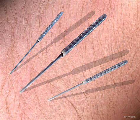 Acupuncture Needles Stock Image M7450177 Science Photo Library
