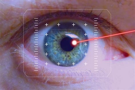 Laser Retinal Surgery Griffeth Vision