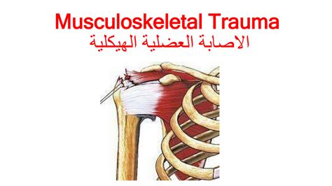 Solution Musculoskeletal Orthopaedic Trauma Nursing Studypool