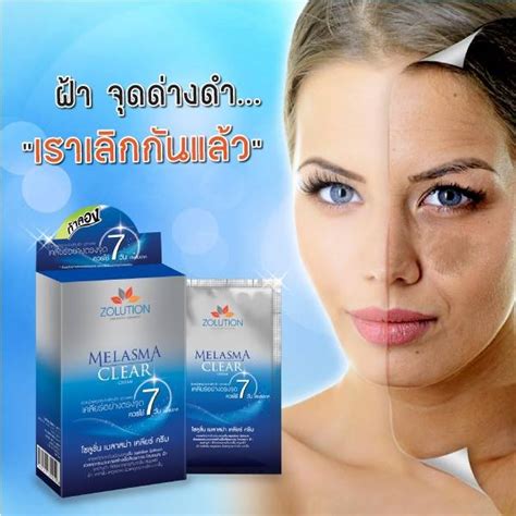 Zolution Melasma Clear Cream For Melasma Dark Spot And Skin Whitening 30g