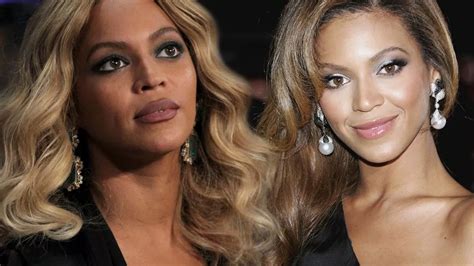 Hollywood Plastic Surgeon Claims Beyonce Appears To Have Had Botox And