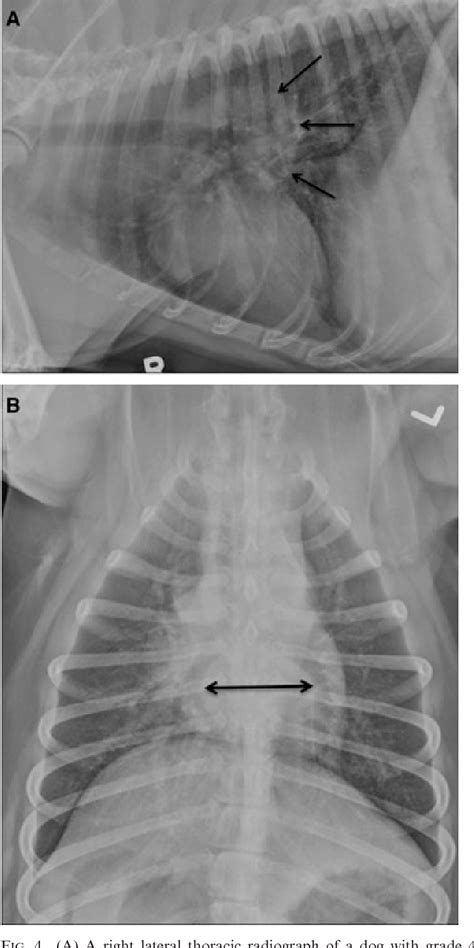 Figure 4 From Relationship Between Radiographic Evidence Of