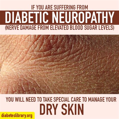 Type 2 Diabetes Dry Skin Naturalskins