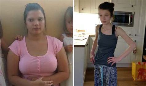 Anorexic Whose Weight Plummeted To Four Stone Warns Of Dangers Of