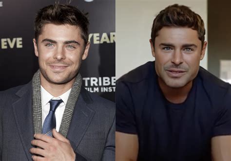 Zac Efrons Jaw Injury The Truth Behind His Changing Face