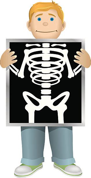 Cartoon Of X Ray For Kids Clip Art Vector Images And Illustrations Istock