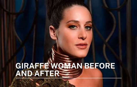 Giraffe Woman Before And After See Giraffe Woman After Removing Her Neck Ring Photos