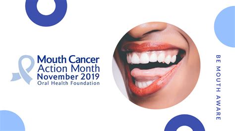 Dentist Basingstoke Newbury Chineham Get Ready For Mouth Cancer