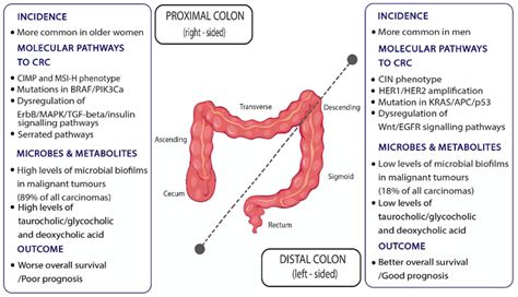 Metabolites Free Full Text Colon Cancer From Epidemiology To