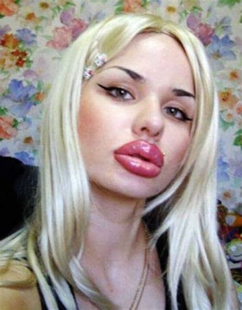 31 Plastic Surgery Gone Wrong Pictures That Will Make You Feel Uncomfortable But You Cant Look