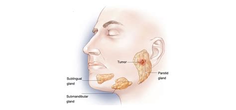 Thyroid Gland The Thyroid Head And Neck Surgery Centre