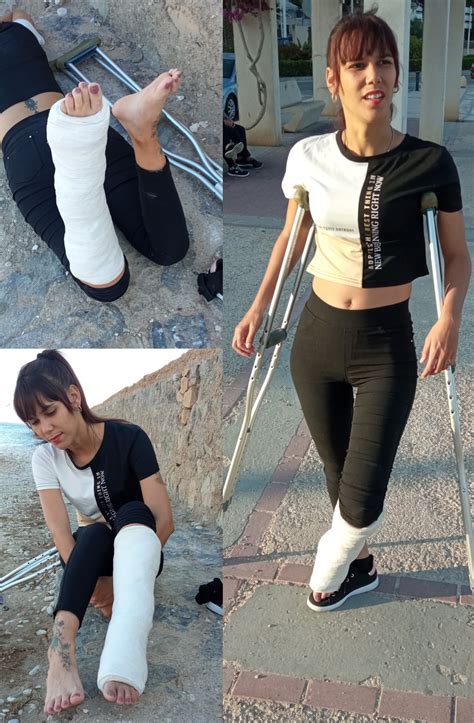 Crutchingaround Casts Braces Sprain Crutches Wheelchair Bandage Cnews
