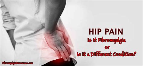 Hip Pain Is It Fibromyalgia Or Is It A Different Condition