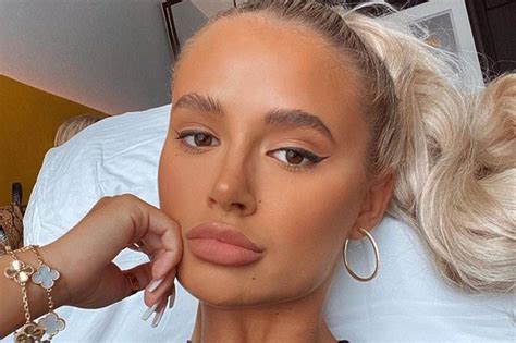 Molly Mae Hague Unveils Natural Lips For First Time As She Gets Fillers