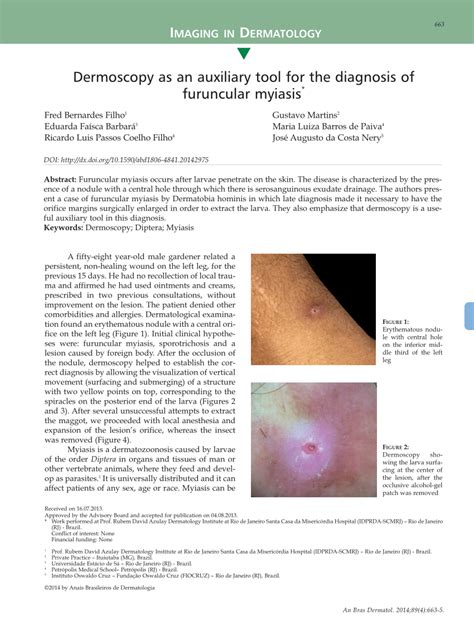 Pdf Dermoscopy As An Auxiliary Tool For The Diagnosis Of Furuncular Myiasis