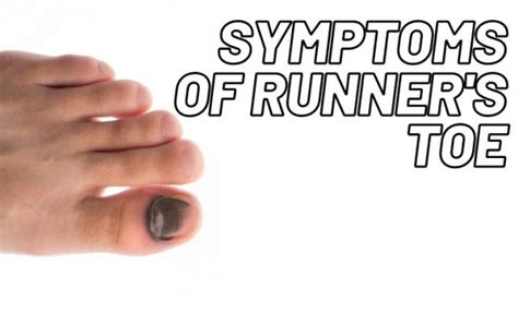 5 Ways To Prevent And Treat Runners Toe Get Back Running
