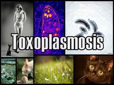 Toxoplasma Gondii Causas Síntomas Y Prevención De La Toxoplasmosis Ppt
