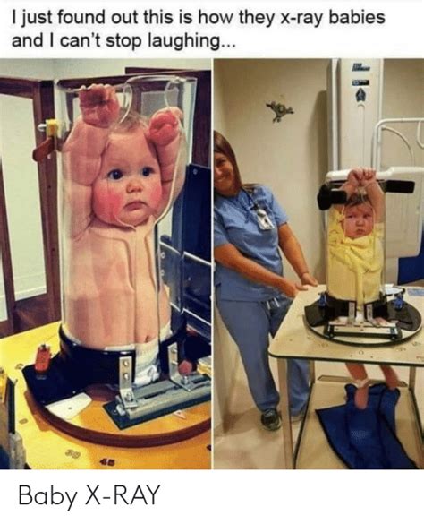Go on to discover millions of awesome videos and pictures in thousands of other categories. Just Found Out This Is How They X-Ray Babies and I Can't Stop Laughing Baby X-Ray | Reddit Meme ...