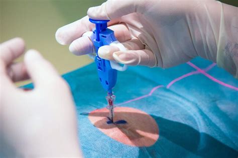 Biopsy Types What To Expect And Uses