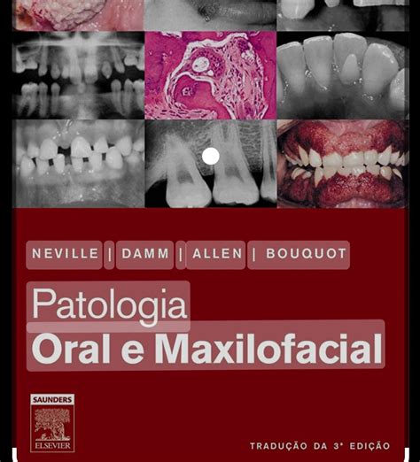 livro patologia oral e maxilofacial livro elsevier usado 86412454 enjoei