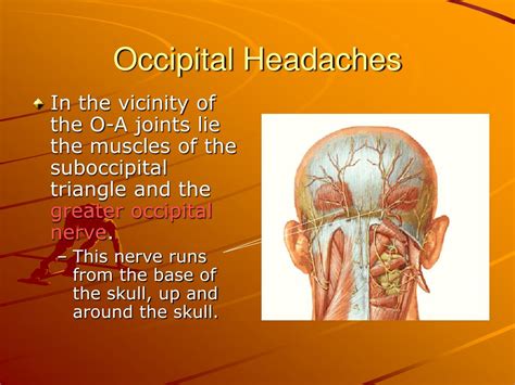 Ppt Occipital Headaches Occipital Neuralgia Powerpoint Presentation Id 3208705