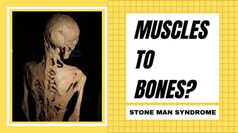 Stone Man Syndrome Do Muscles Turn To Bones Youtube