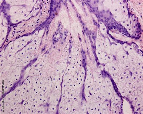 Human Skin Sebaceous Gland Stock Photo Adobe Stock