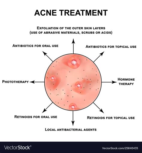 Acne Treatment Pustules Papules Comedones Vector Image