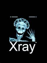 Photos of X Ray School Online
