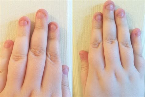 How To Stop Biting My Nails For Good Nailstip