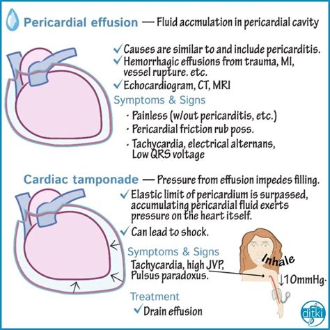 Symptoms Of Pericardial Effusion Mesothelioma Cancer Lawyers