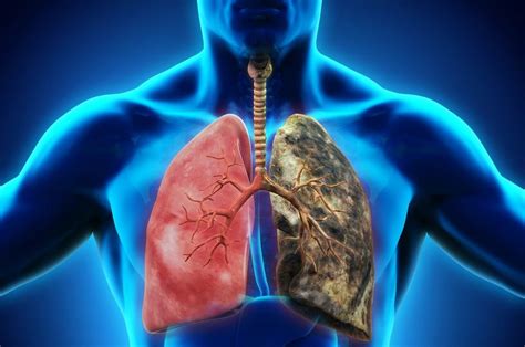 Respiratory Diseases Everything About It Just Ask Medical