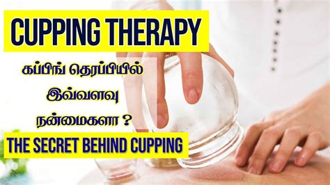 பிரபலமாகி வரும் Cupping Therapy Does Cupping Therapy Work Side Effects Benefits And Types