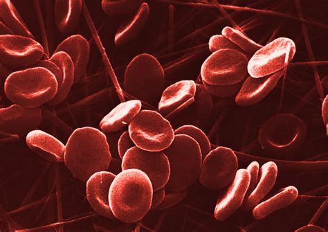 1ère Autotransfusion De Globules Rouges Créés à Partir De Cellules