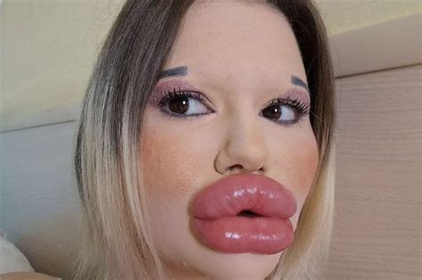 la mujer con los labios más grandes del mundo quiere más relleno a pesar de que los fanáticos