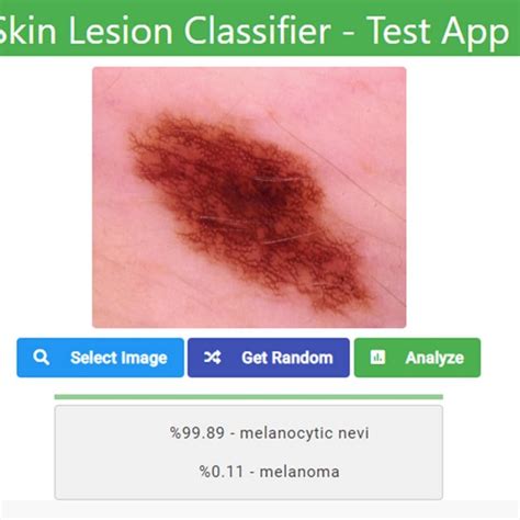 The Skin Lesion Classifier Web Application Download Scientific Diagram