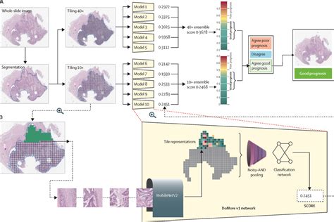 Deep Learning For Prediction Of Colorectal Cancer Outcome A Discovery