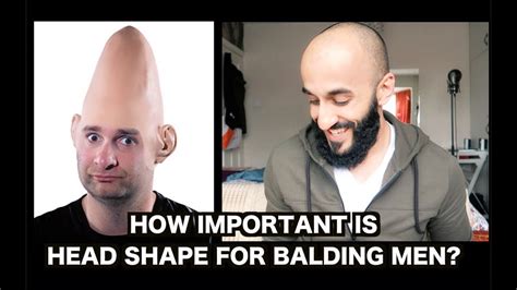 How Important Is Head Shape For Balding Men Hair Loss Motivation