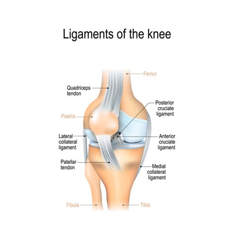 A ligament sprain happens when the fibres that make depending on the knee ligament injury that you have, your health professional may advise you to wear a special brace to support your knee while the. Knee Sprain - Harvard Health