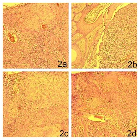 A Clinical Manifestation Of A Tumour Prior The Surgical Excision B Download Scientific