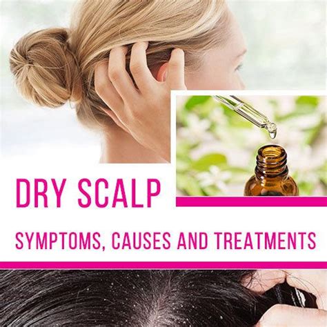 Dry Scalp Problem Symptoms Causes And Treatments Trong 2020