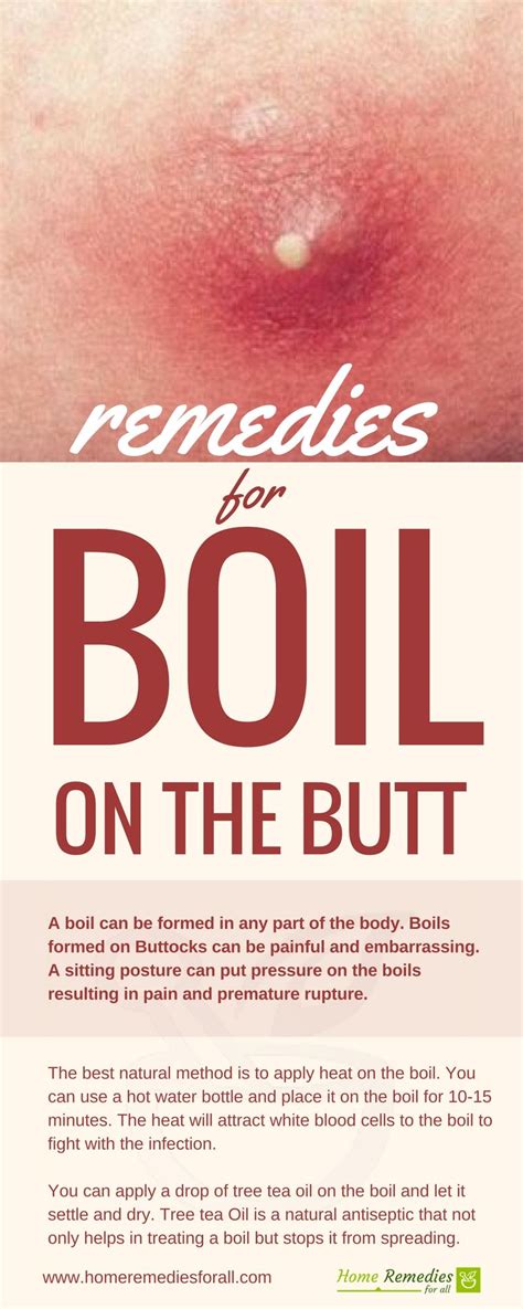 Remove Boil On Your Butt To Get Fast And Lasting Relief From The Pain