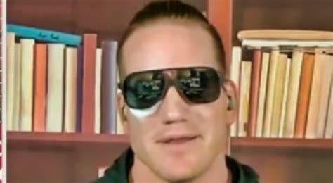 Aj Hawk Showed Off His Eye Injury During The Pat Mcafee Show