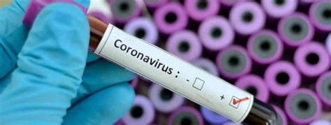 ¿se dice síntomas del covid o síntomas de covid? Coronavirus COVID-19 tarda cinco días en mostrar primeros síntomas | La Primera Plana