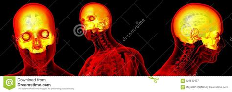 3d Rendering Medical Of The Upper Skull Stock Illustration