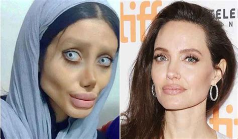 Has This Teen Really Had 50 Surgeries To Look Like
