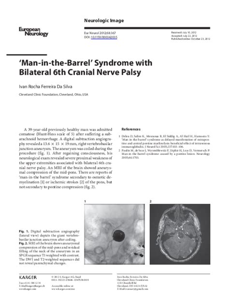 Pdf ‘man In The Barrel Syndrome With Bilateral 6th Cranial Nerve