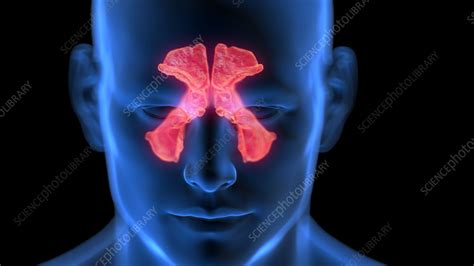 Inflamed Sinuses Illustration Stock Image F0384500 Science
