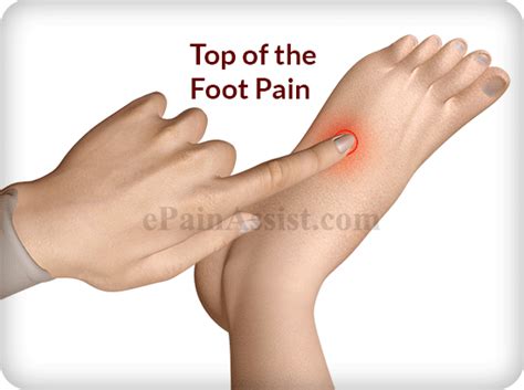 Top Of The Foot Pain Treatment Exercises Causes Symptoms